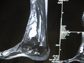 coimbatore-orthopaedic-joint-replacement-maternity-child-welfare-centre-india